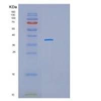 人黑色素瘤抗原家族A8(MAGEA8)重组蛋白