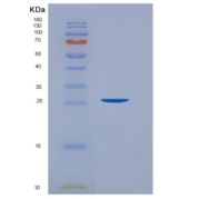 人白血病抑制因子(LIF)重组蛋白