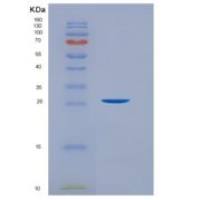 人白血病抑制因子(LIF)重组蛋白