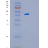大肠杆菌髓鞘碱性蛋白(MBP)重组蛋白