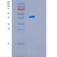 大肠杆菌髓鞘碱性蛋白(MBP)重组蛋白