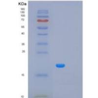 人甘露糖-6-磷酸受体(M6PR)重组蛋白