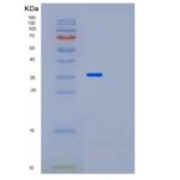 人亮氨酸丰富α2-糖蛋白1(LRG1)重组蛋白