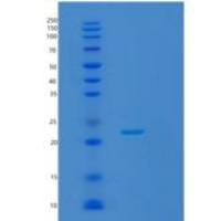 小鼠脂质运载蛋白2(LCN2)重组蛋白