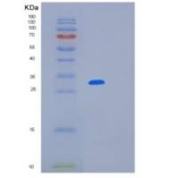 人LRRC59重组蛋白