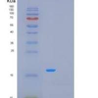 人甲基丙二酰辅酶A异构酶(MCEE)重组蛋白
