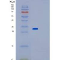 人赖氨酰氧化酶(LOX)重组蛋白