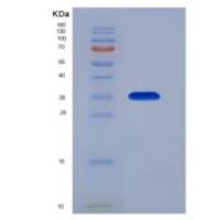 人二肽酶3(DPEP3)重组蛋白