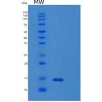 人LAMTOR4重组蛋白
