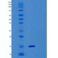 人瘦素人类重组体重组蛋白