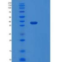人丝裂原激活蛋白激酶激酶6(MAP2K6)重组蛋白