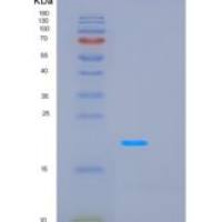 人脂质运载蛋白2(LCN2)重组蛋白