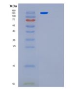 人LRS（亮氨酰tRNA合成酶）重组蛋白