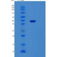人半乳糖凝集素8(GAL8)重组蛋白