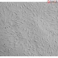 人心脏成纤维细胞-成人