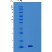 人LAIR-1（胞外结构域；22-125aa重组蛋白