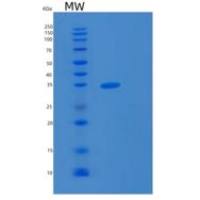 人微管关联蛋白RP/EB家族成员3(MAPRE3)重组蛋白