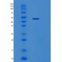 人丝裂原激活蛋白激酶13(MAPK13)重组蛋白