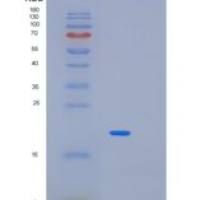 人MYC关联因子X(MAX)重组蛋白