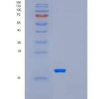 人U6小核糖核酸相关Sm样蛋白重组蛋白