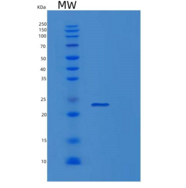 人淋巴毒素β受体(LTbR)重组蛋白