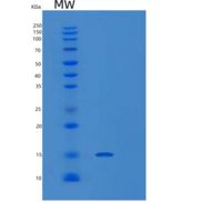 小鼠白细胞关联免疫球蛋白样受体1(LAIR1)重组蛋白