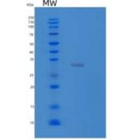 小鼠LGALS3重组蛋白