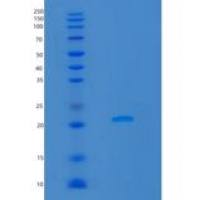 大鼠脂质运载蛋白2(LCN2)重组蛋白