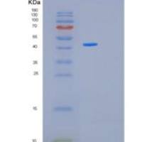 人丝裂原激活蛋白激酶12(MAPK12)重组蛋白