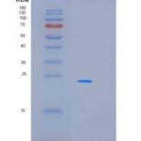 人髓鞘碱性蛋白(MBP)重组蛋白