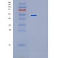 人溶血卵磷脂酰基转移酶1(LPCAT1)重组蛋白