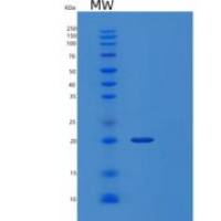 人中脑星形胶质细胞来源神经营养因子(MANF)重组蛋白