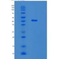 人乳腺丝抑蛋白(Maspin)重组蛋白