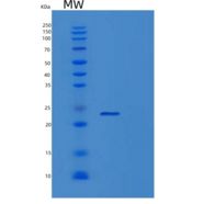 人淋巴毒素β受体(LTbR)重组蛋白