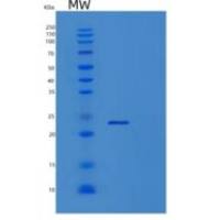人淋巴毒素β受体(LTbR)重组蛋白