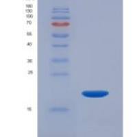 人微管关联蛋白1轻链3β2(MAP1LC3b2)重组蛋白