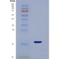 小鼠半乳糖凝集素9(GAL9)重组蛋白