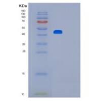 人LIM同源盒转录因子1-β（LMX1B）重组蛋白