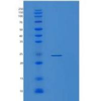 人淋巴管内皮细胞透明质酸受体1(LYVE1)重组蛋白