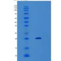 人LGALSL重组蛋白