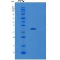 人LIME1重组蛋白