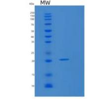 人MARCKS相关蛋白(MARCKSL1)重组蛋白