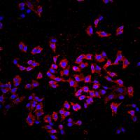 BrdU免疫荧光染色