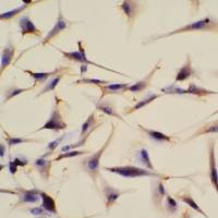 IHC免疫组化实验服务