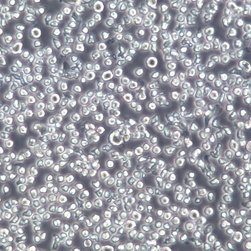 NOMO-1、NOMO-1细胞系、NOMO-1细胞株、NOMO-1人白血病细胞