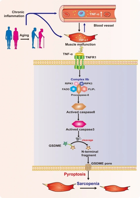 Elabscience靶标解读丨“肿瘤杀手”-肿瘤坏死因子α