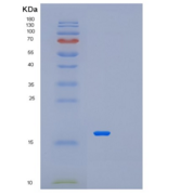 人METTL21A重组蛋白
