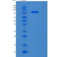 人黏病毒耐药蛋白1(MX1)重组蛋白