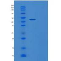 人甲硫氨酰氨肽酶1(METAP1)重组蛋白