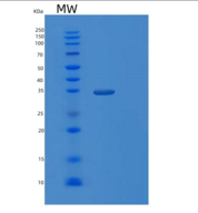 人大肠杆菌mdh重组蛋白